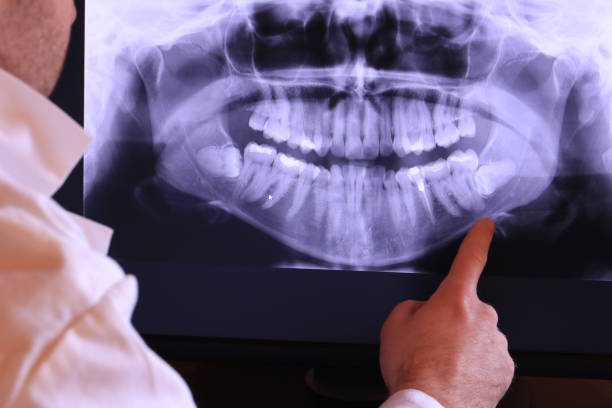 Best Emergency Cosmetic Dentistry (e.g., broken veneers) in Stinnett, TX